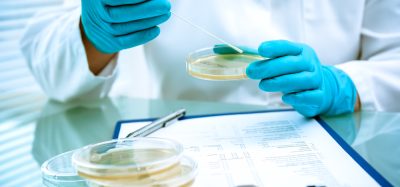 Streamlined Listeria monocytogenes test slashes detection time for food samples